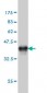 PSMD5 Antibody (monoclonal) (M01)